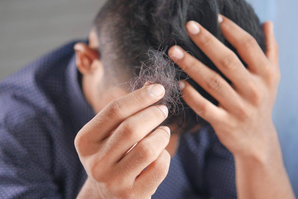 which-vitamin-deficiency-causes-hair-loss-a-complete-guide-revival-at-30